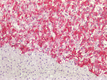 ACVRL1 Antibody