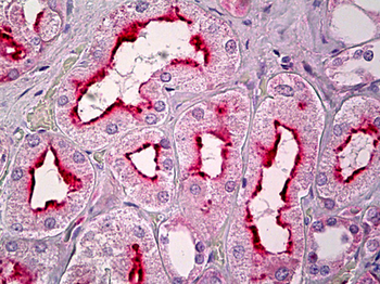GPCR6/GPR101 Antibody