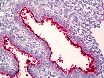 MUC16/CA125 Antibody