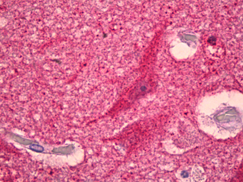 GPR151 Antibody