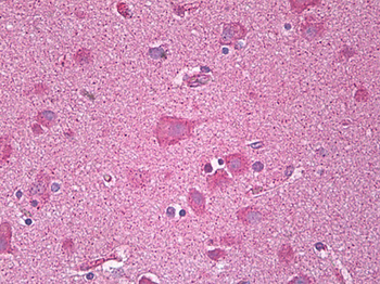 CXCR3 Antibody