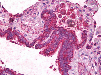 ANGPT1/Angiopoietin-1 Antibody