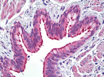 WC1/ATP7B Antibody