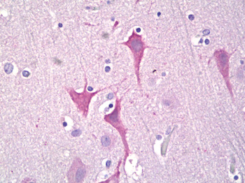 PRKD1/PKC Mu Antibody