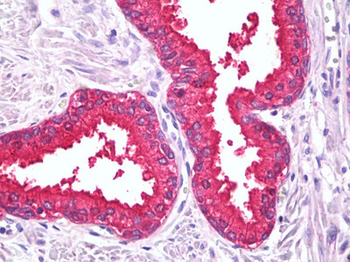 TPH1/Tryptophan Hydroxylase Antibody