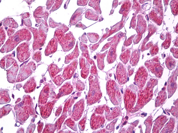 MARK2 Antibody