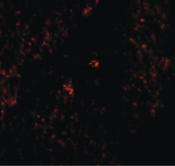 HMMR/CD168/RHAMM Antibody