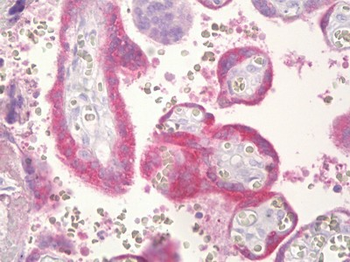 CGB/hCG Beta Antibody