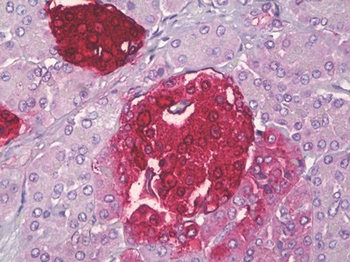SST/Somatostatin Antibody