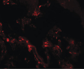 TM4SF1 Antibody