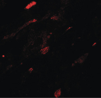TGM5/Transglutaminase 5 Antibody