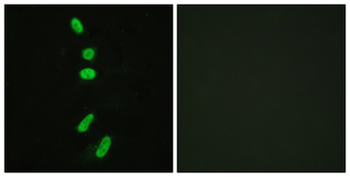 SF1 Antibody