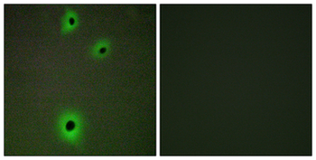 IGSF4C/CADM4 Antibody