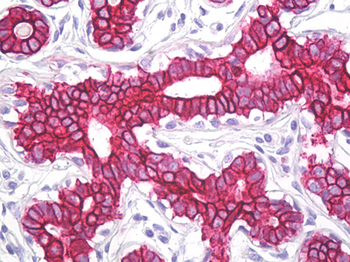 KRT8/CK8/Cytokeratin 8 Antibody