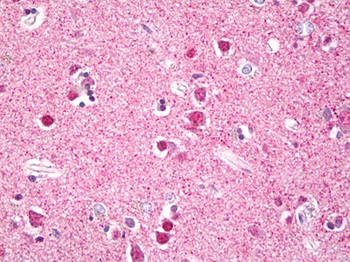 RPS6KA5/MSK1 Antibody
