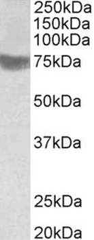 RNF139/TRC8 Antibody