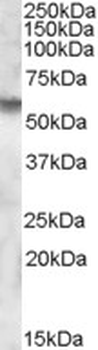 IDS/Iduronate 2 Sulfatase Antibody