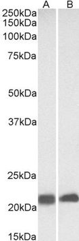 CAV3/Caveolin 3 Antibody