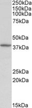 DCN/Decorin Antibody