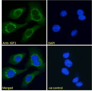 IGF1 Antibody