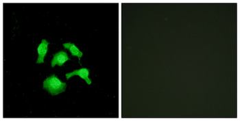 TSC22D1/TSC22 Antibody