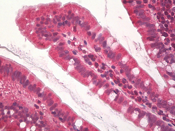 JHDM1A/KDM2A Antibody