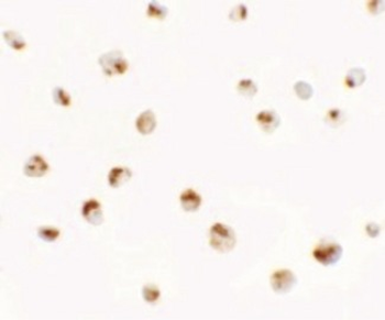 CBT1/SDHD Antibody