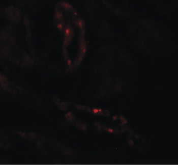SCUBE3 Antibody