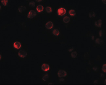 ATG2B Antibody