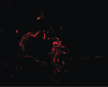 FACL2/ACSL1 Antibody