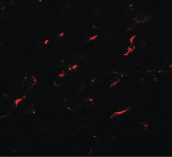 FMNL1 Antibody