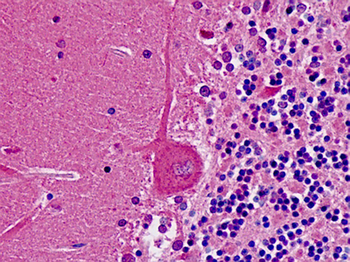 PNMT Antibody