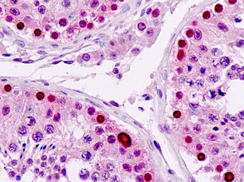 LSM2/SnRNP Antibody