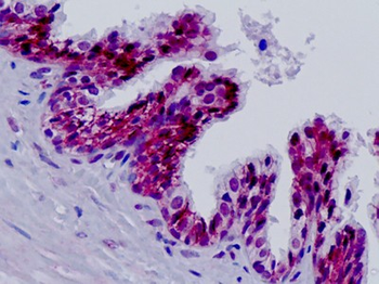 ERCC5/XPG Antibody
