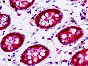 IP6K2 Antibody