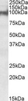 PKP2/Plakophilin 2 Antibody