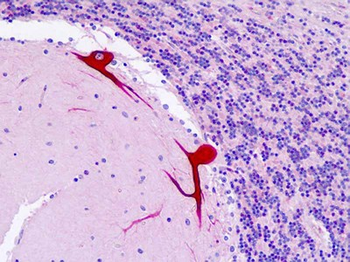 DAB1 Antibody