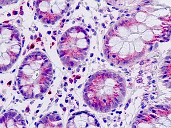 DAB1 Antibody