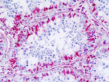 CHRM4/M4 Antibody