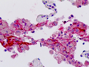 F2R/Thrombin Receptor/PAR1 Antibody