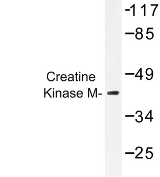 CKM/Creatine Kinase MM Antibody