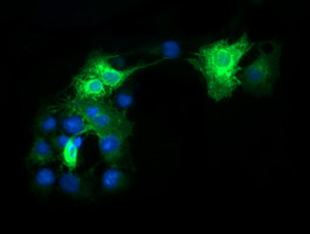 FCGR1A/CD64 Antibody