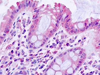 TGFBR1/ALK5 Antibody