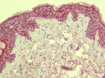 ANKLE1 Antibody
