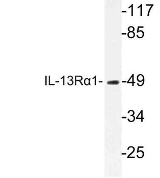 IL13RA1/IL13R Alpha 1 Antibody