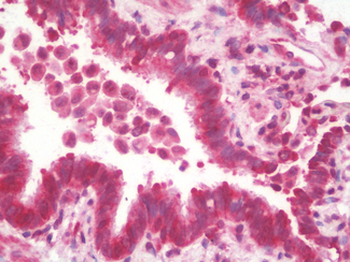 MRPL13 Antibody