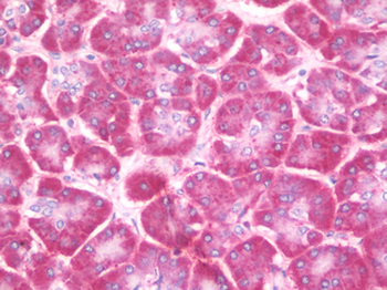 CEP290 Antibody