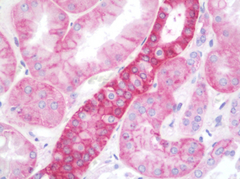 RAB1A Antibody
