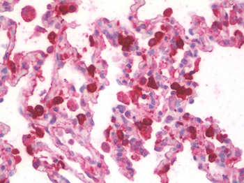 SFTPA1 + SFTPA2 Antibody