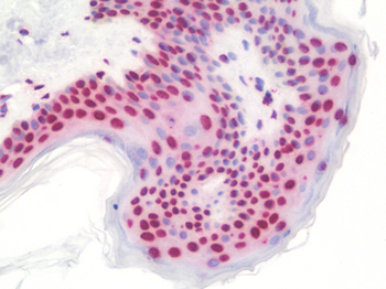 POM121 Antibody